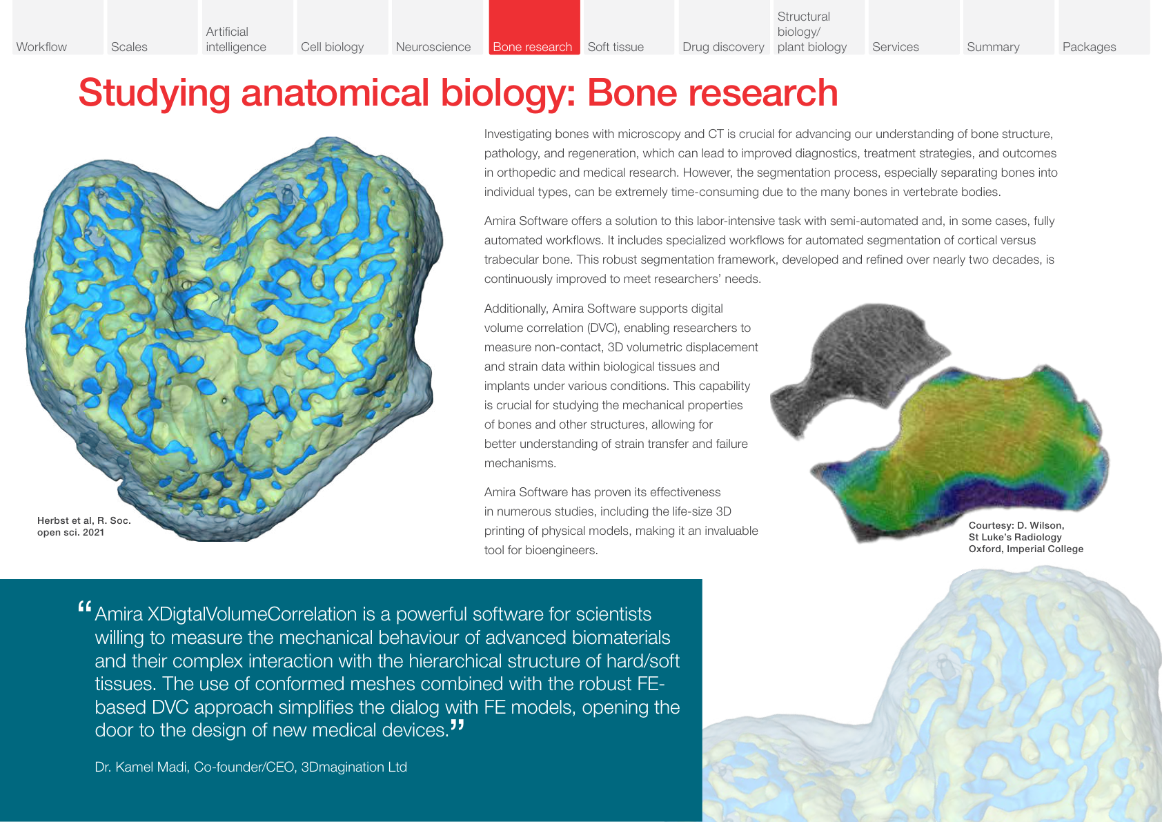 Bone Research